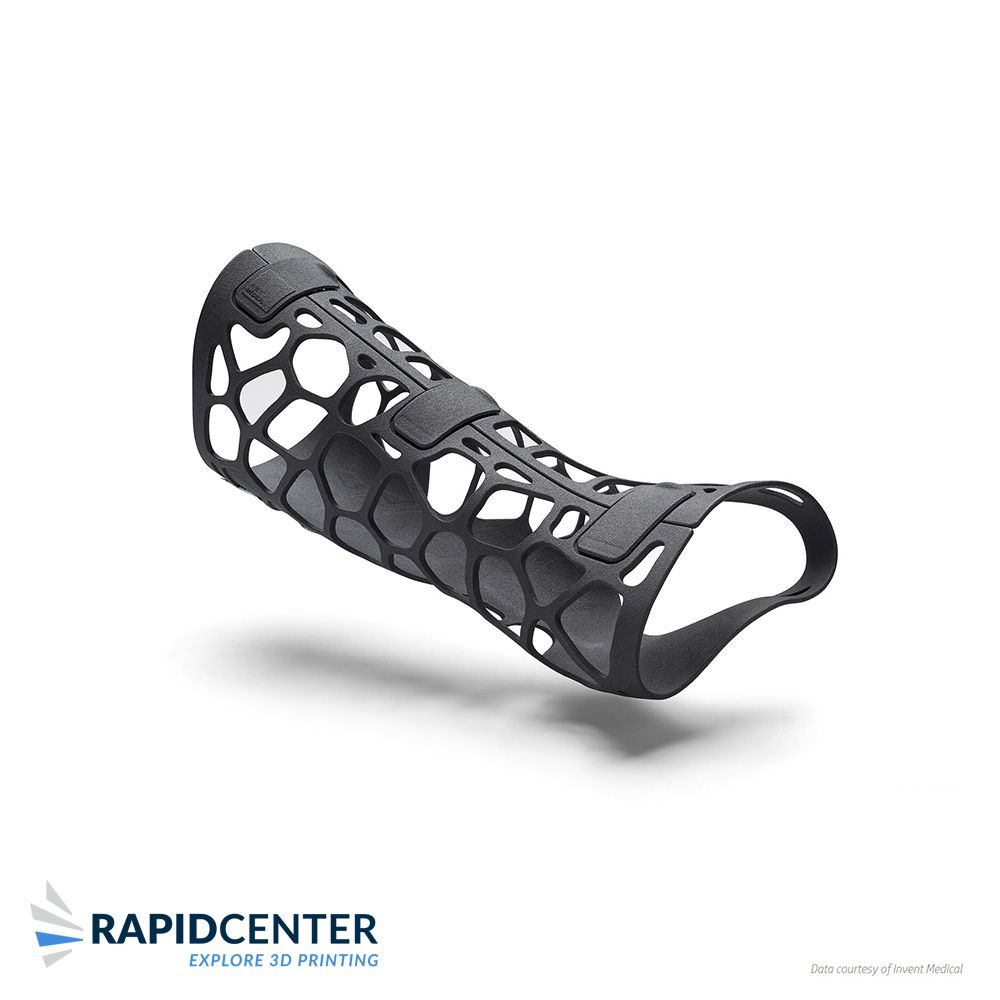 3D printed arm cast